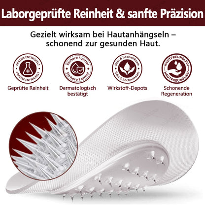 KUBOZN® OryzaDarts TAG’GONE – Schmerzfreie Entfernung an der Wurzel dank Schwarzer-Reis-Mikrotechnologie ✨ (offer)