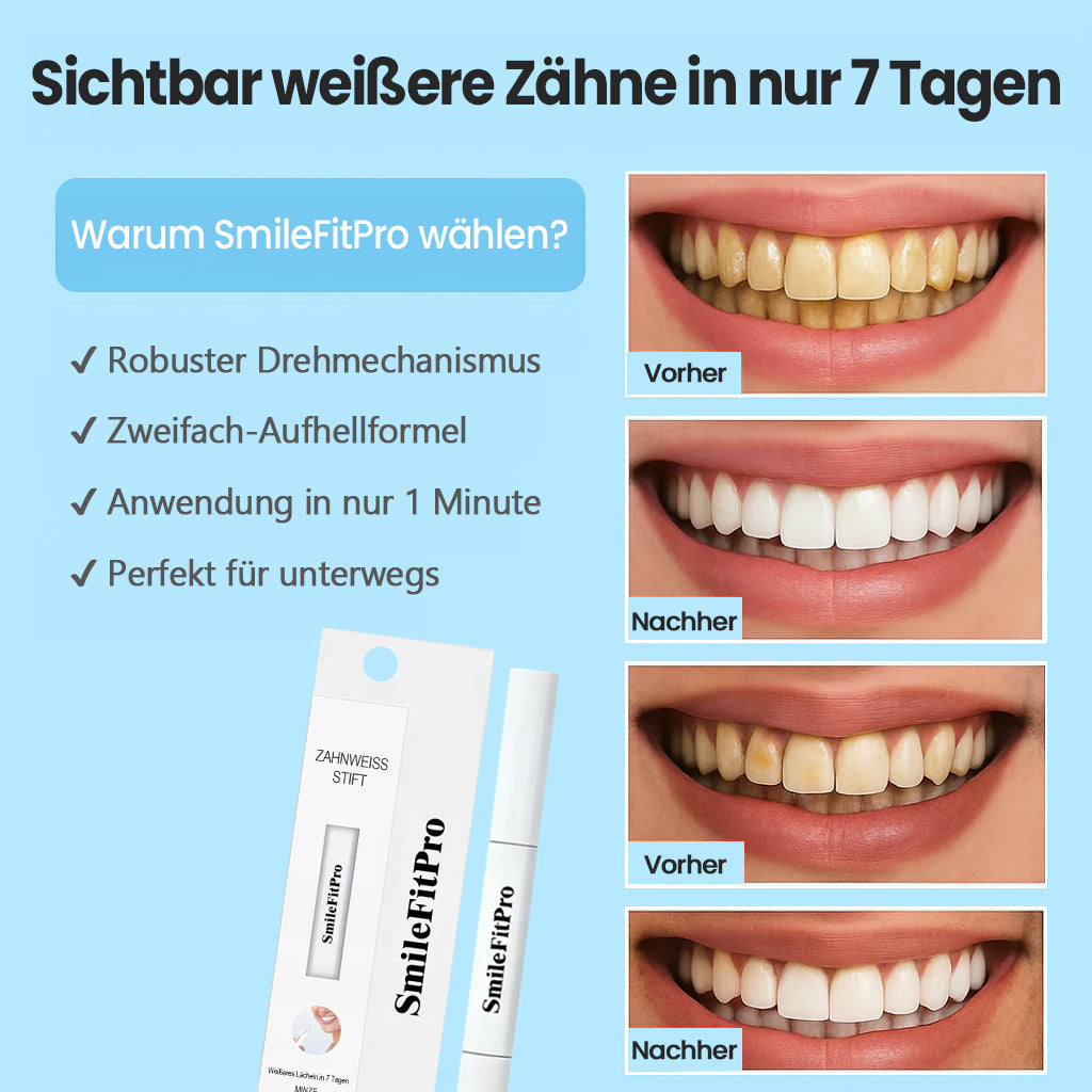 Cvreoz® SmileFitPro Zahnaufhellungsstift