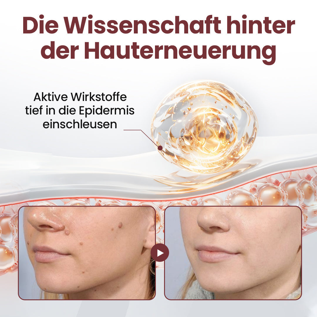 ⭐ Cvreoz® OryzaClear – Schwarzreis-Extrakt Creme gegen Hautanhänge & raue Stellen – sanft, pflanzlich & sichtbar wirksam (Offer)