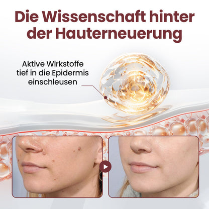 ⭐ Cvreoz® OryzaClear – Schwarzreis-Extrakt Creme gegen Hautanhänge & raue Stellen – sanft, pflanzlich & sichtbar wirksam (Offer)