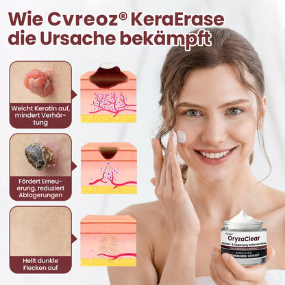 ⭐ Cvreoz® OryzaClear – Schwarzreis-Extrakt Creme gegen Hautanhänge & raue Stellen – sanft, pflanzlich & sichtbar wirksam (Offer)