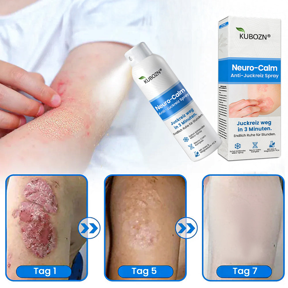 ✅Kubozn® Magnesium Kräuter-Psoriasis Spray  (offer)
