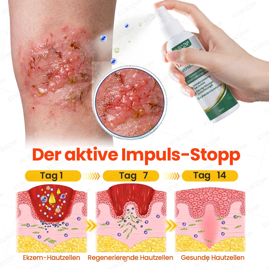 KUBOZN® Eczem & Neurodermitis Set – 24h Pflege bei Juckreiz, Rötungen & geschädigter Haut