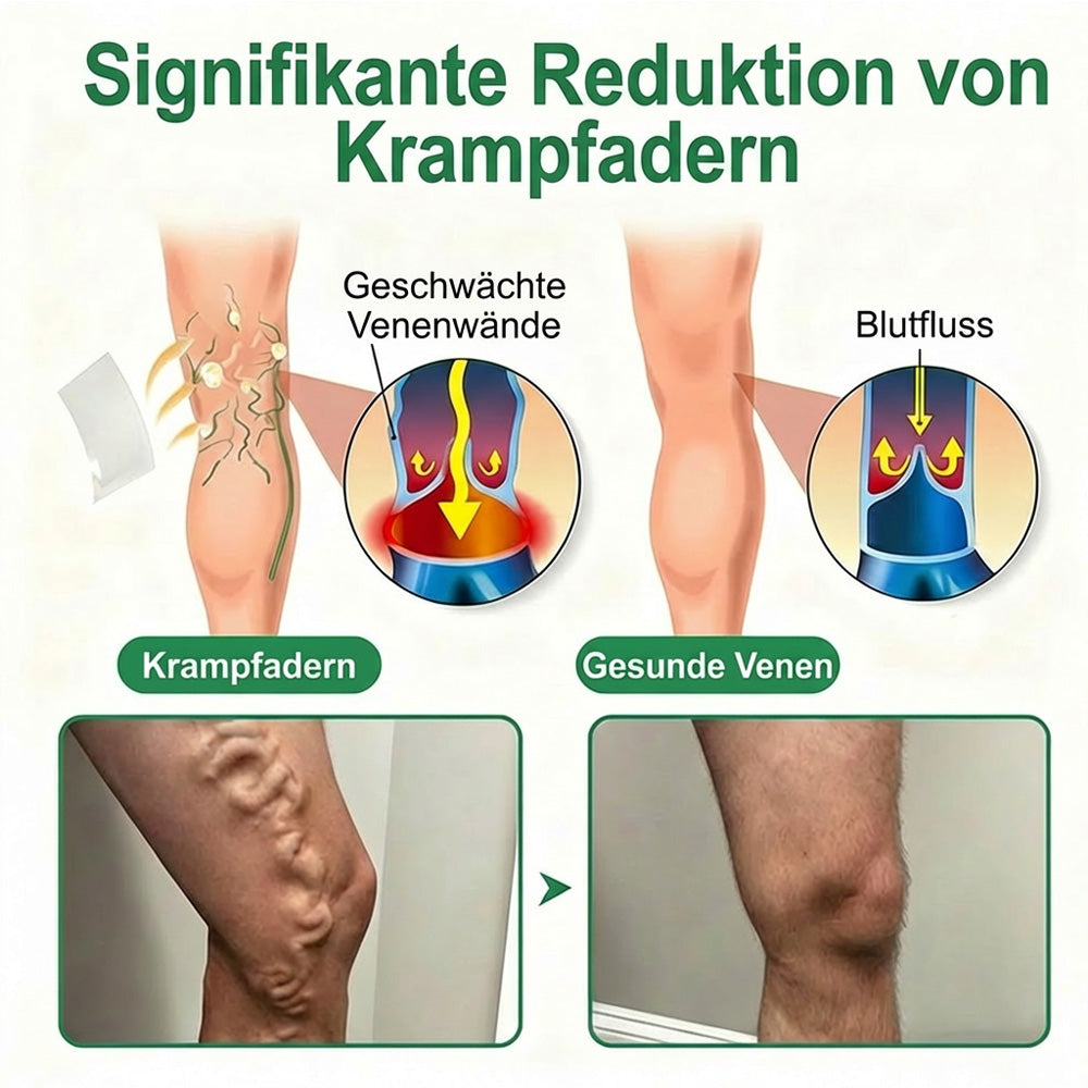👨‍⚕️🔥Healrize® VeinEase Mikronadel-Technologie⚡Spürbare Wirkung in Tagen – nachhaltige Verbesserung (offer)