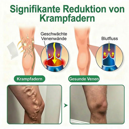 👨‍⚕️🔥Healrize® VeinEase Mikronadel-Technologie⚡Spürbare Wirkung in Tagen – nachhaltige Verbesserung (offer)