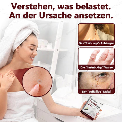 KUBOZN® OryzaDarts TAG’GONE – Schmerzfreie Entfernung an der Wurzel dank Schwarzer-Reis-Mikrotechnologie ✨ (offer)