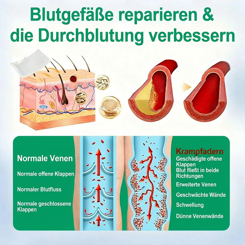 👨‍⚕️🔥Healrize® VeinEase Mikronadel-Technologie⚡Spürbare Wirkung in Tagen – nachhaltige Verbesserung (offer)