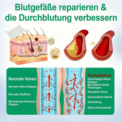 👨‍⚕️🔥Healrize® VeinEase Mikronadel-Technologie⚡Spürbare Wirkung in Tagen – nachhaltige Verbesserung (offer)