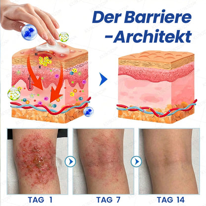 KUBOZN® Eczem & Neurodermitis Set – 24h Pflege bei Juckreiz, Rötungen & geschädigter Haut