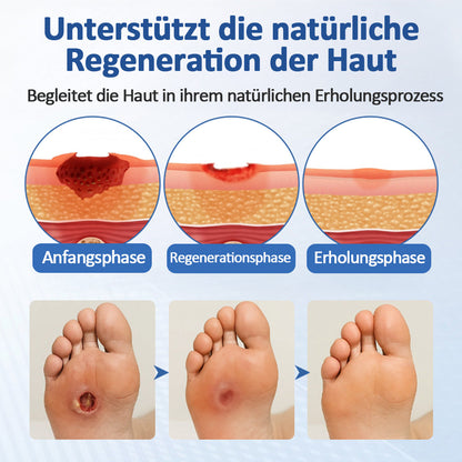 Healrize® GlucoDerm Barriere-Spray