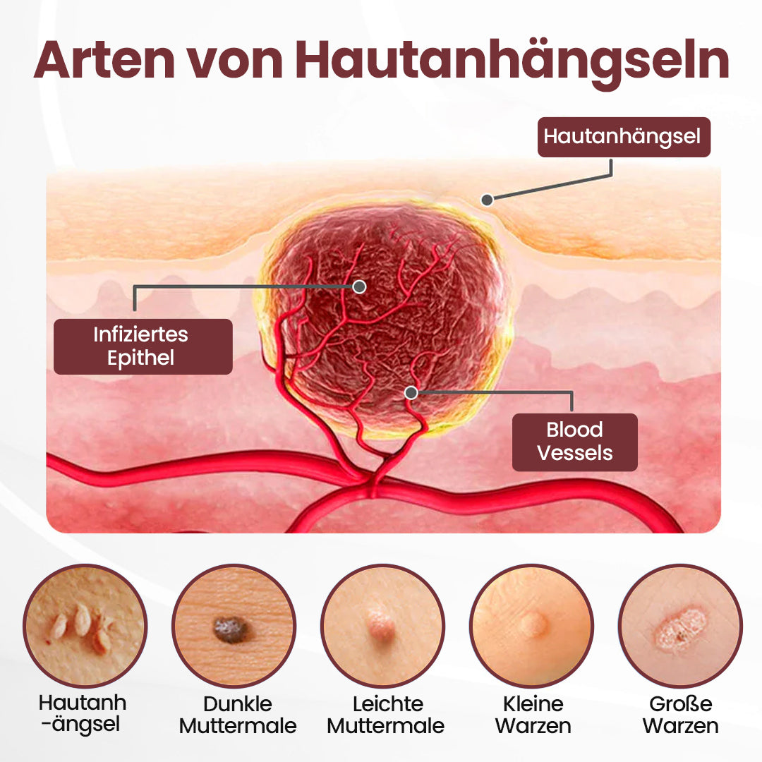 ⭐ Cvreoz® OryzaClear – Schwarzreis-Extrakt Creme gegen Hautanhänge & raue Stellen – sanft, pflanzlich & sichtbar wirksam (Offer)