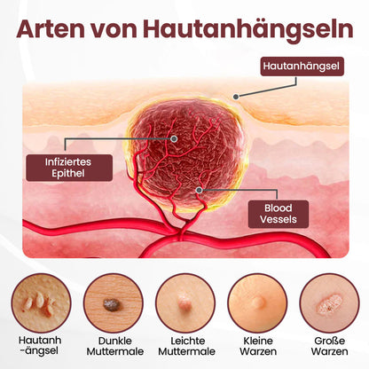 ⭐ Cvreoz® OryzaClear – Schwarzreis-Extrakt Creme gegen Hautanhänge & raue Stellen – sanft, pflanzlich & sichtbar wirksam (Offer)