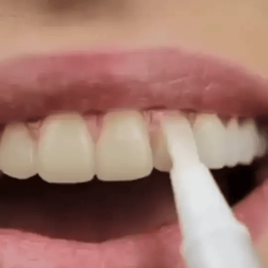 Cvreoz® SmileFitPro Zahnaufhellungsstift