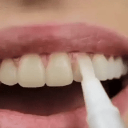 Cvreoz® SmileFitPro Zahnaufhellungsstift