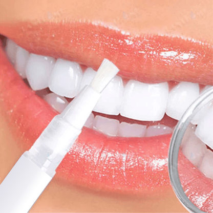 Cvreoz® SmileFitPro Zahnaufhellungsstift